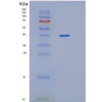 人HAPLN1重组蛋白