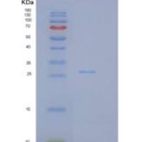 人GSTP1重组蛋白