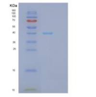 人GPD1L重组蛋白