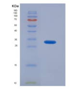 人磷脂酰肌醇蛋白聚糖4(GPC4)重组蛋白