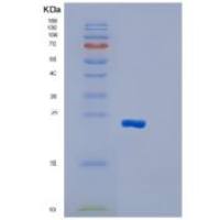人谷胱甘肽S转移酶μ1(GSTM1)重组蛋白
