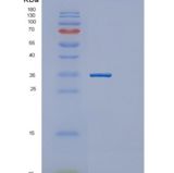 人甘氨酸-N-甲基转移酶(GNMT)重组蛋白产品图