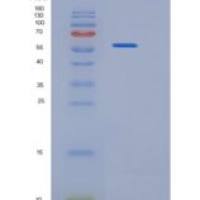 人组氨tRNA合成酶(HARS)重组蛋白