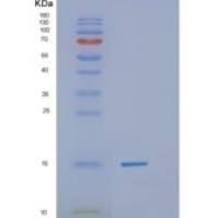 人H2A组蛋白家族成员Z(H2AFZ)重组蛋白