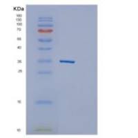 人GNPDA1重组蛋白