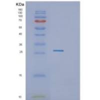 人颗粒酶H(GZMH)重组蛋白
