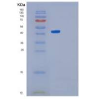 人GNAI1重组蛋白