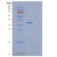 人GNB2L1重组蛋白