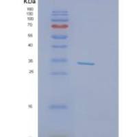 人谷胱甘肽S转移酶θ1(GSTt1)重组蛋白