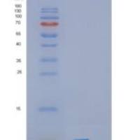 人高迁移率族核小体结合域蛋白1(HMGN1)重组蛋白