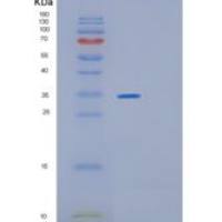 大肠杆菌glsA1重组蛋白