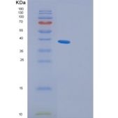 人含PDZ结构域的蛋白GIP C1（GIP C1）重组蛋白