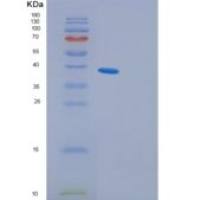 人含PDZ结构域的蛋白GIP C1（GIP C1）重组蛋白