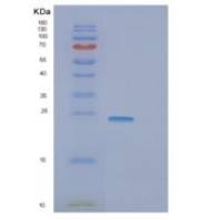 人GNPNAT1重组蛋白