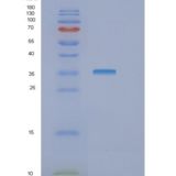 人GTF2B重组蛋白