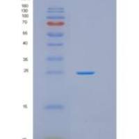 人谷胱甘肽S转移酶κ1(GSTk1)重组蛋白