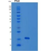 人GMF-γ重组蛋白