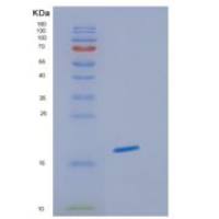 人血红蛋白γ1(HBg1)重组蛋白