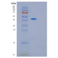 人GNAI2重组蛋白