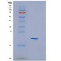 人HBXIP重组蛋白