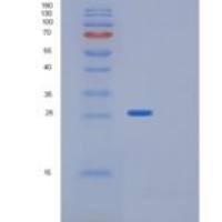 人GLTPD1重组蛋白