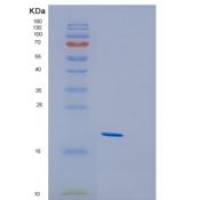 人Gremlin 2蛋白(GREM2)重组蛋白
