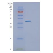 大肠杆菌glk重组蛋白
