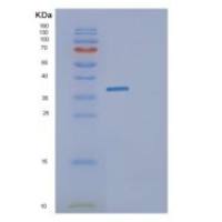 大肠杆菌glk重组蛋白