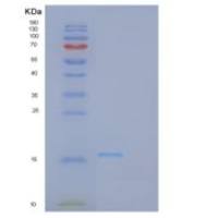 人血小板膜糖蛋白Ⅺ(GP9)重组蛋白