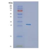 人颗粒酶K(GZMK)重组蛋白