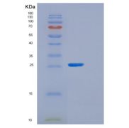 大肠杆菌(grxB)重组蛋白产品图