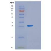 大肠杆菌(grxB)重组蛋白