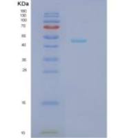 人羟烷基辅酶A脱氢酶β(HADHb)重组蛋白