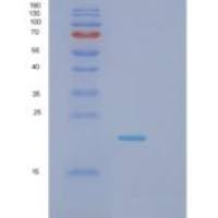 小鼠乙二醛酶Ⅰ(GLO1)重组蛋白