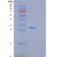 人GSTM5重组蛋白