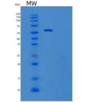 小鼠Gpt重组蛋白