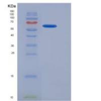 人通用转录因子ⅡA肽1(GTF2A1)重组蛋白