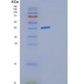 大肠杆菌gldA(E.coli gldA)重组蛋白产品图