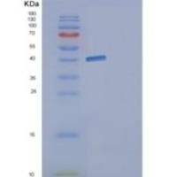 大肠杆菌gldA(E.coli gldA)重组蛋白