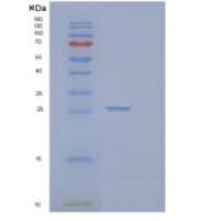 人马来酰乙酰乙酸异构酶(GSTZ1)重组蛋白