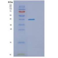 人G蛋白β1(GNb1)重组蛋白