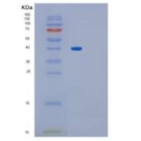 人糖原素1(Glycogenin 1)重组蛋白