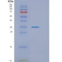 人GTF2E2重组蛋白