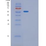 大肠杆菌glpK重组蛋白产品图