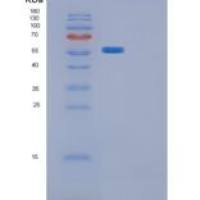 大肠杆菌glpK重组蛋白