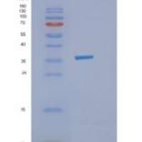 人甲型H1N1流感重组蛋白
