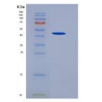 人粒细胞巨噬细胞集落刺激因子2(GM-CSF)重组蛋白