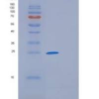 人胃动蛋白1(GKN1)重组蛋白