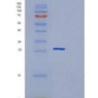 人谷胱甘肽S转移酶μ2(GSTM2)重组蛋白