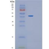 人GDP-甘露糖4，6脱水酶（GMDS）重组蛋白